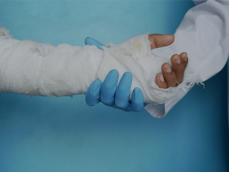 burn injury lawyer in Glendale